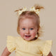 Lemon Piggy Tail Hair Clips - Pair - Thumbnail 5